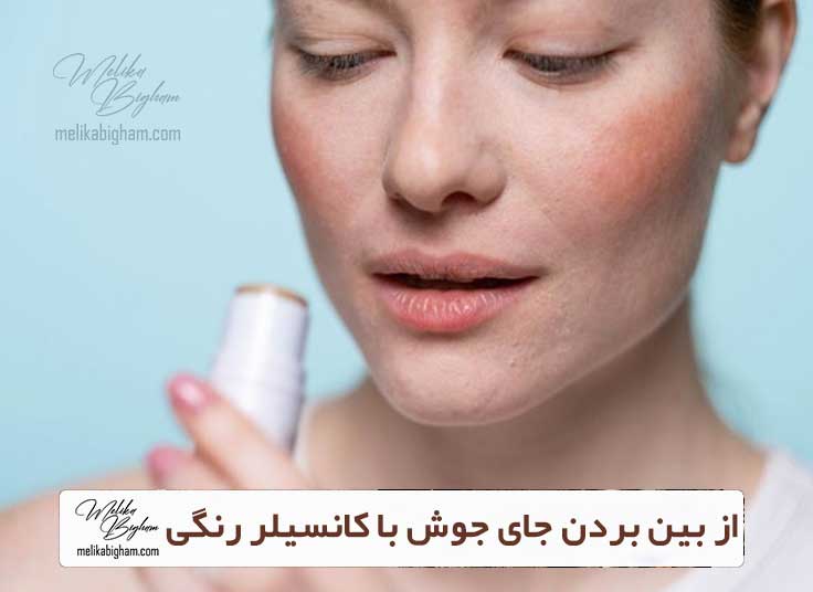 از بین بردن جای جوش با کانسیلر رنگی