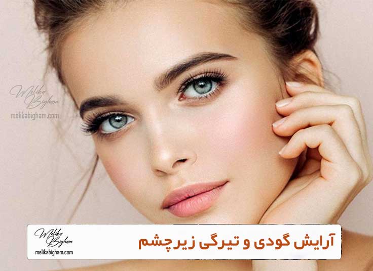 آرایش گودی و تیرگی زیرچشم