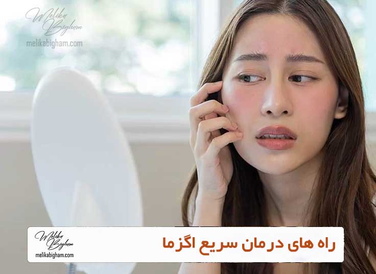 راه های درمان سریع اگزما