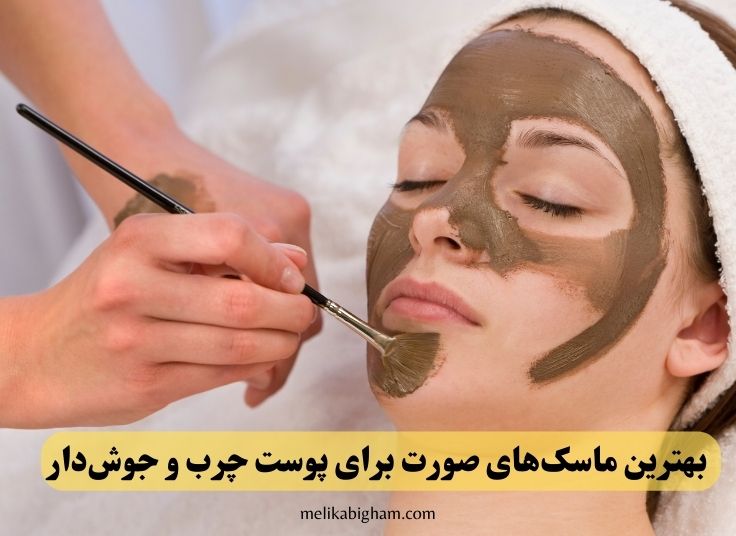 بهترین ماسک های صورت برای پوست چرب و جوش دار