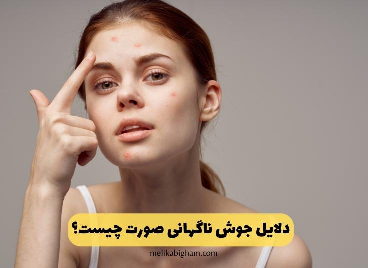 دلایل جوش ناگهانی صورت چیست؟