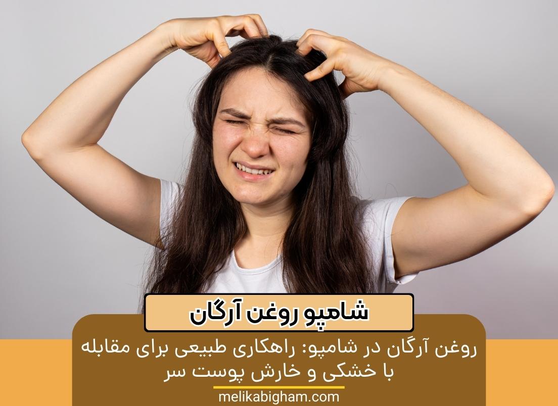 روغن آرگان در شامپو راهکاری طبیعی برای مقابله با خشکی و خارش پوست سر1