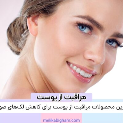 بهترین محصولات مراقبت از پوست برای کاهش لک‌های صورت