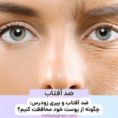 ضد آفتاب و پیری زودرس: چگونه از پوست خود محافظت کنیم؟