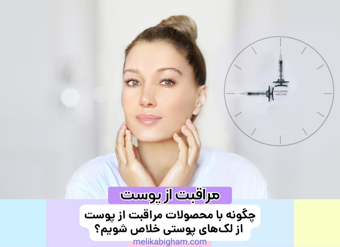 چگونه با محصولات مراقبت از پوست از لک‌های پوستی خلاص شویم؟