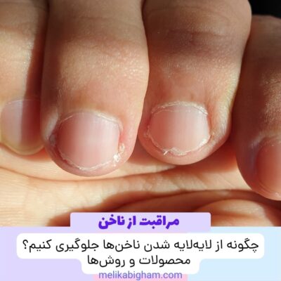 چگونه از لایه‌لایه شدن ناخن‌ها جلوگیری کنیم؟ محصولات و روش‌ها
