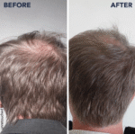 قرص تقویت مو و ناخن فیتو PHYTO PARIS PHYTOPHANERE HAIR & NAILS - Image 6