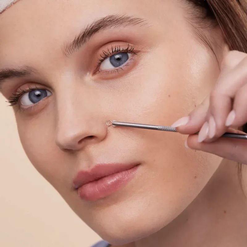 قلم از بین‌برنده جوش و سرسیاه دو سر Double-Ended Blackhead Remover - تصویر 3