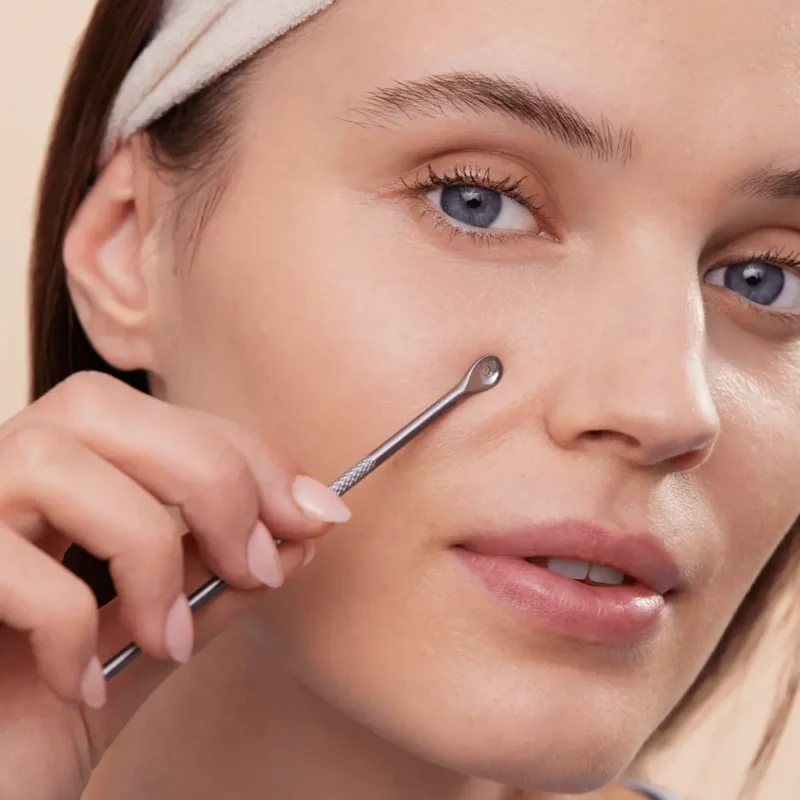 قلم از بین‌برنده جوش و سرسیاه دو سر Double-Ended Blackhead Remover - تصویر 2
